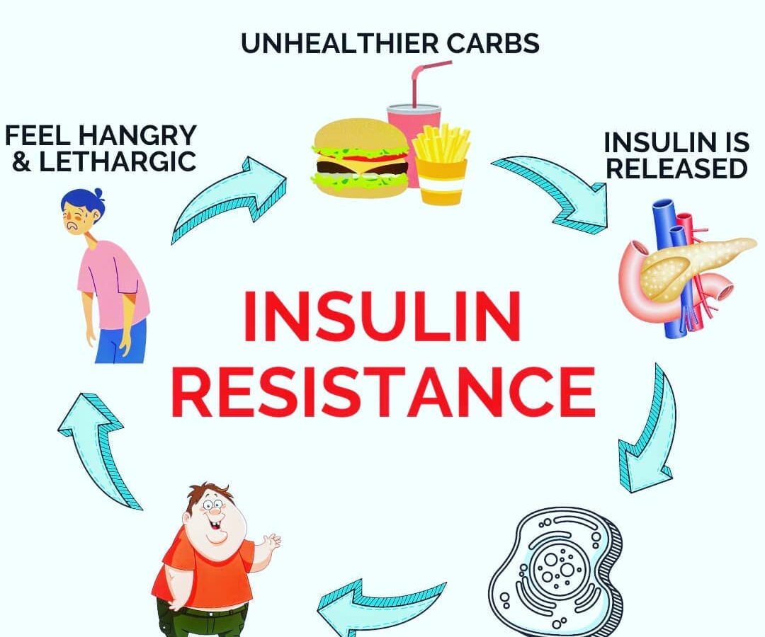 Αντίσταση στην Ινσουλίνη